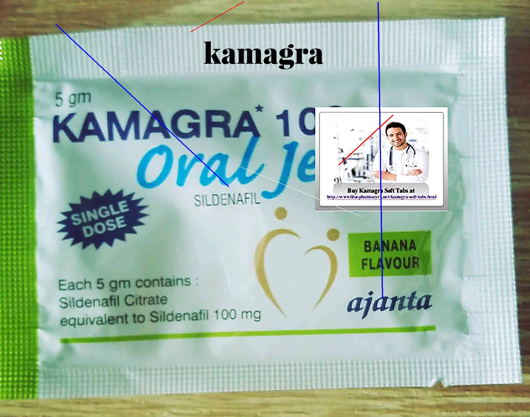 Acheter kamagra doctissimo